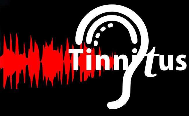 Exploring Sound Therapy to Cope with Tinnitus